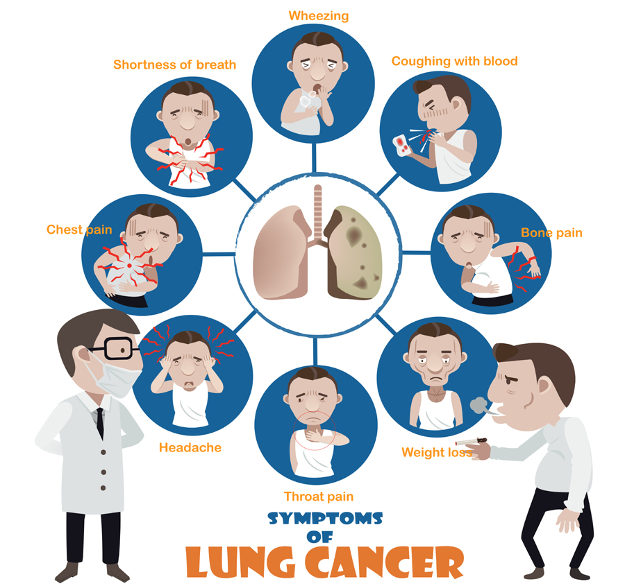 Lung Cancer The Risks Of Lung Cancer