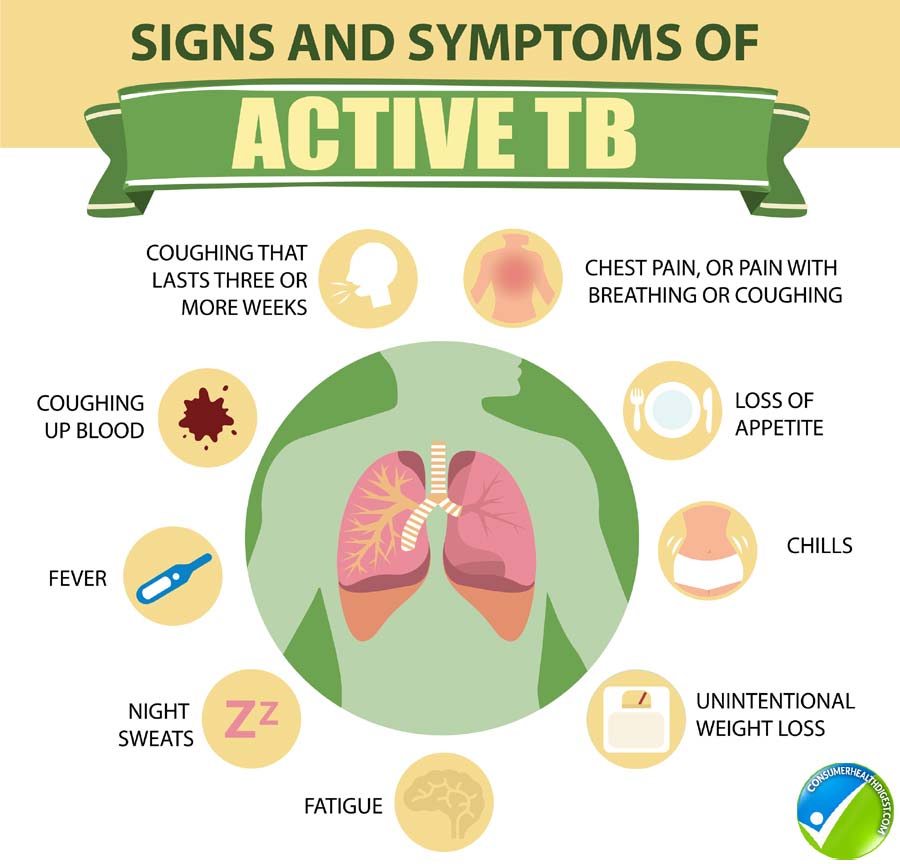 Tuberculosis Disease Symptoms