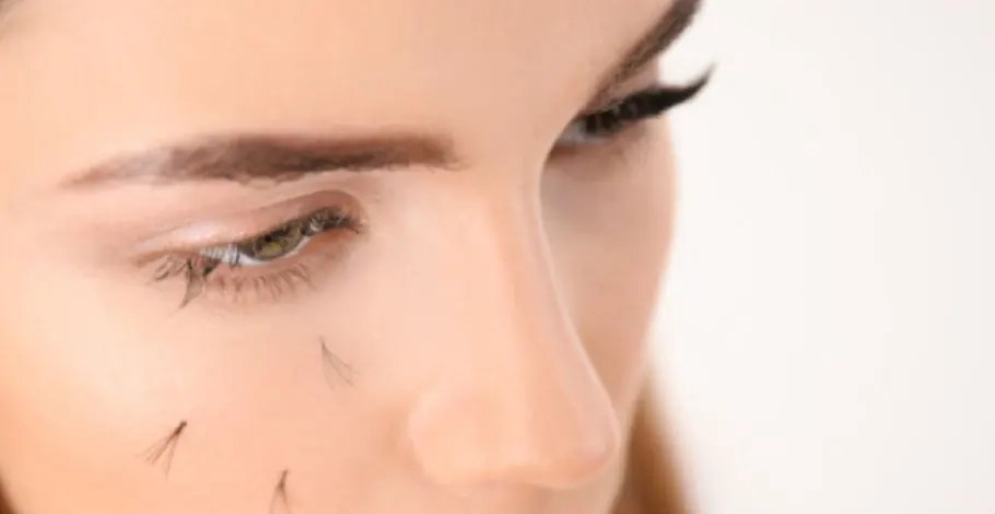 Eyelashes Falling Out – What Are The Causes & Treatment?