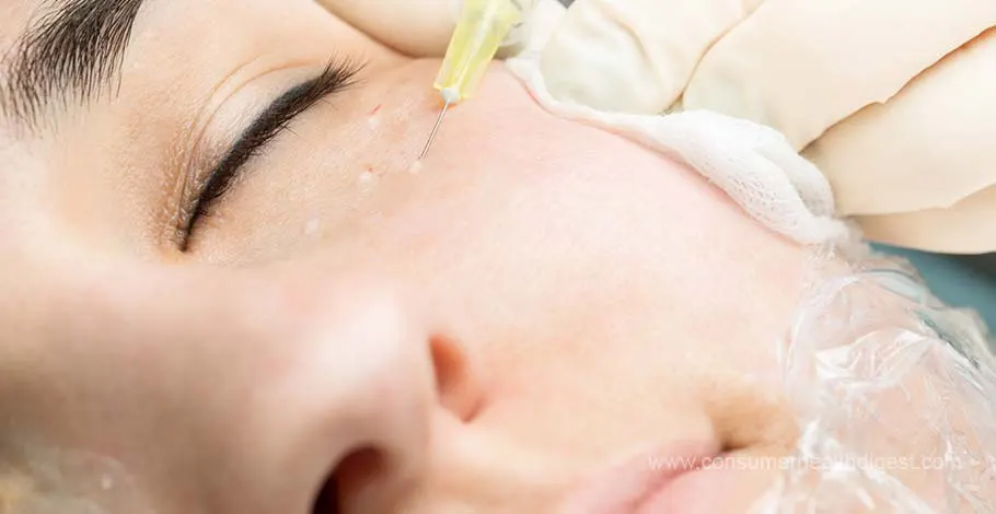 Botox: Is botox safe for under eyes wrinkle treatment?