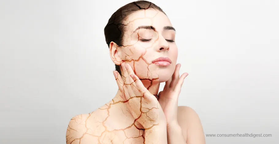 Understanding Dry Skin: Causes, Symptoms, and Remedies