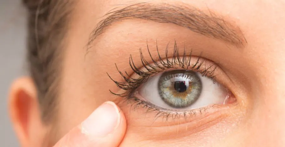 Eyelash Growth Abnormalities – Causes and Expert Solution!