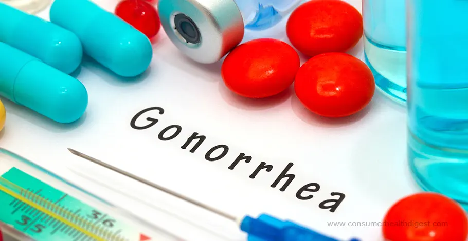 Gonorrhea Signs And Symptoms Diagnosis Treatment And Prevention 5758