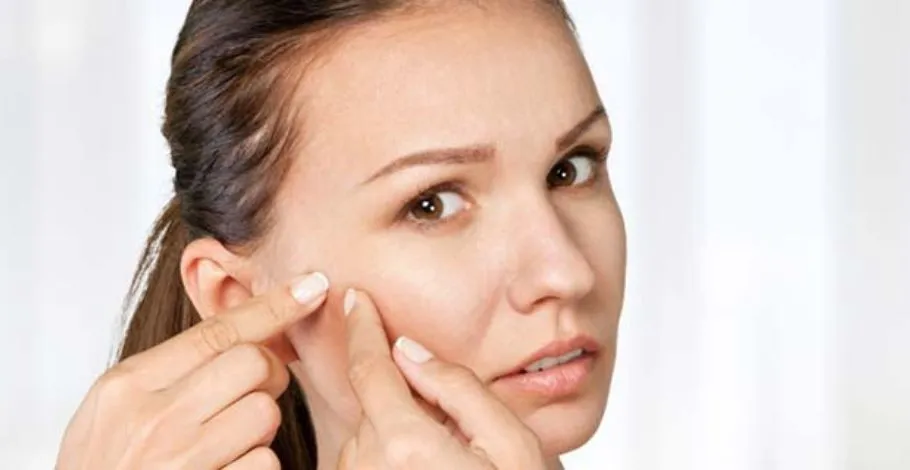 Are Your Product Clogging Pores? – Get Rid of Clogged Pores